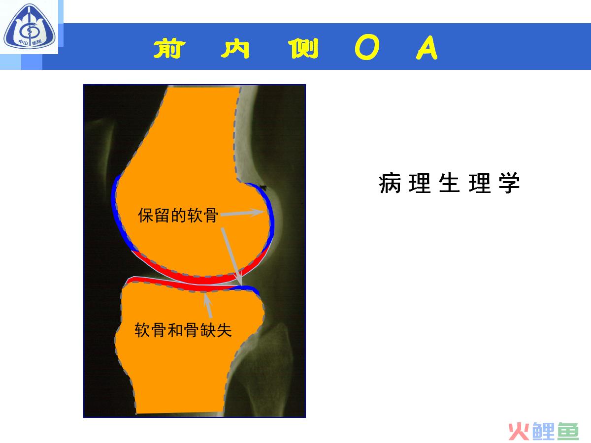 普遍性策略的 什么是普遍性分布策略 