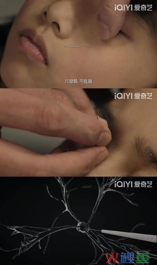 《谢谢你医生》《促醒者》等同台打擂,医疗剧走向“社会化”?