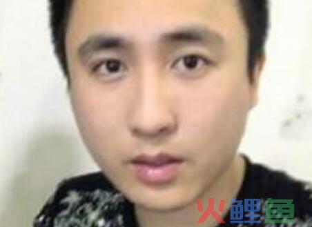 散打哥直播透凄凉，右耳或永久性失聪。